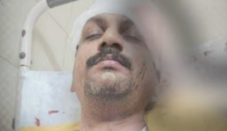 ബീരിയാണി തീർന്നെന്ന് പറഞ്ഞു ;കോഴിക്കോട് ഹോട്ടല് ജീവനക്കാരനെ മര്ദ്ദിച്ച് പരിക്കേല്പ്പിച്ചതായി പരാതി